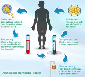 stemcelltransplant-graphic